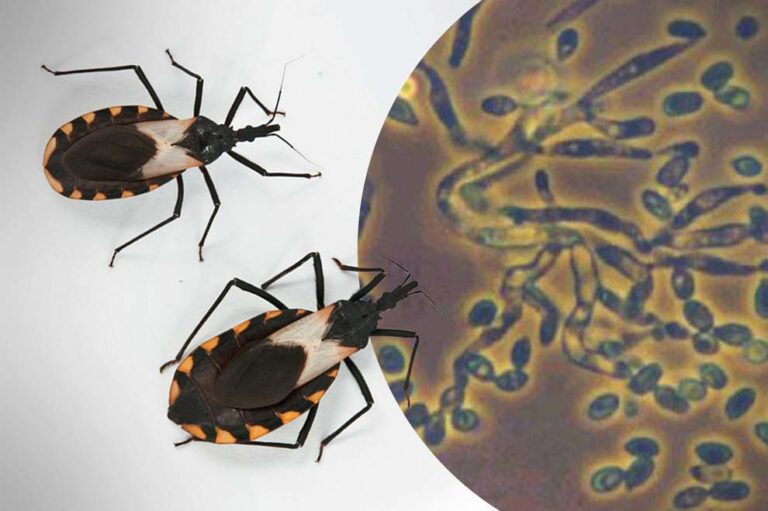 El chagas persiste en México